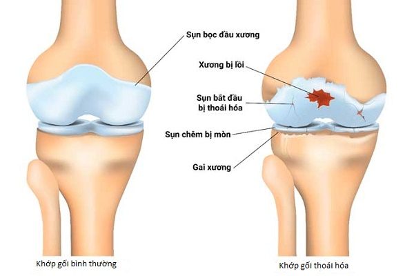 img-tin tức