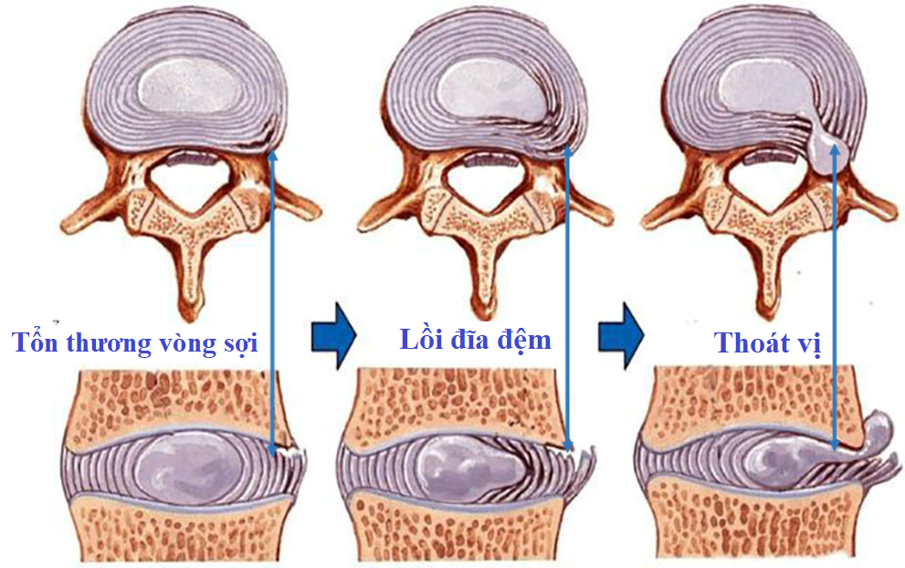 img-tin tức