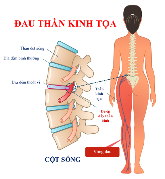 img-tin tức